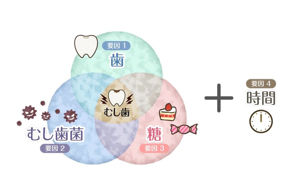 むし歯の原因とは?