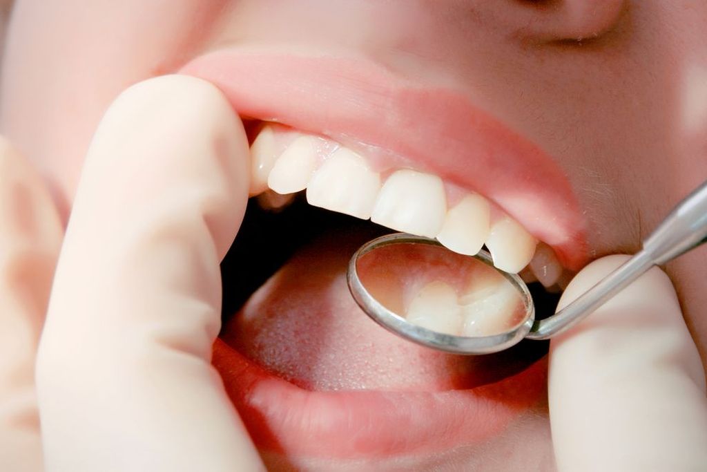 むし歯は自然治癒するの?